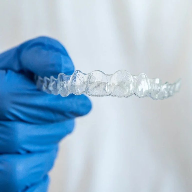 3DifferentTypesofRetainersAfterBraces