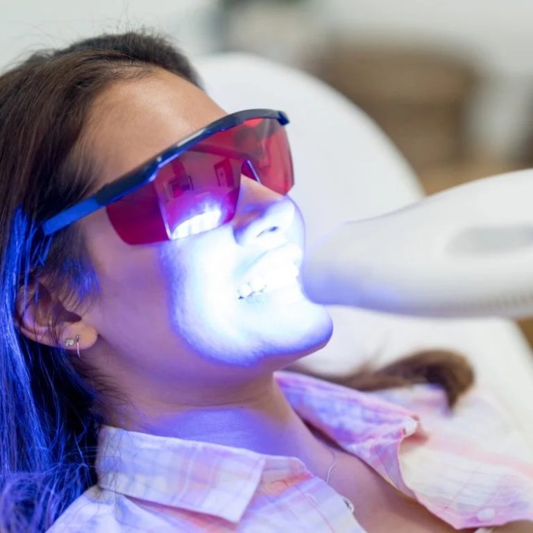 AccordingtoaKitchenerDentist