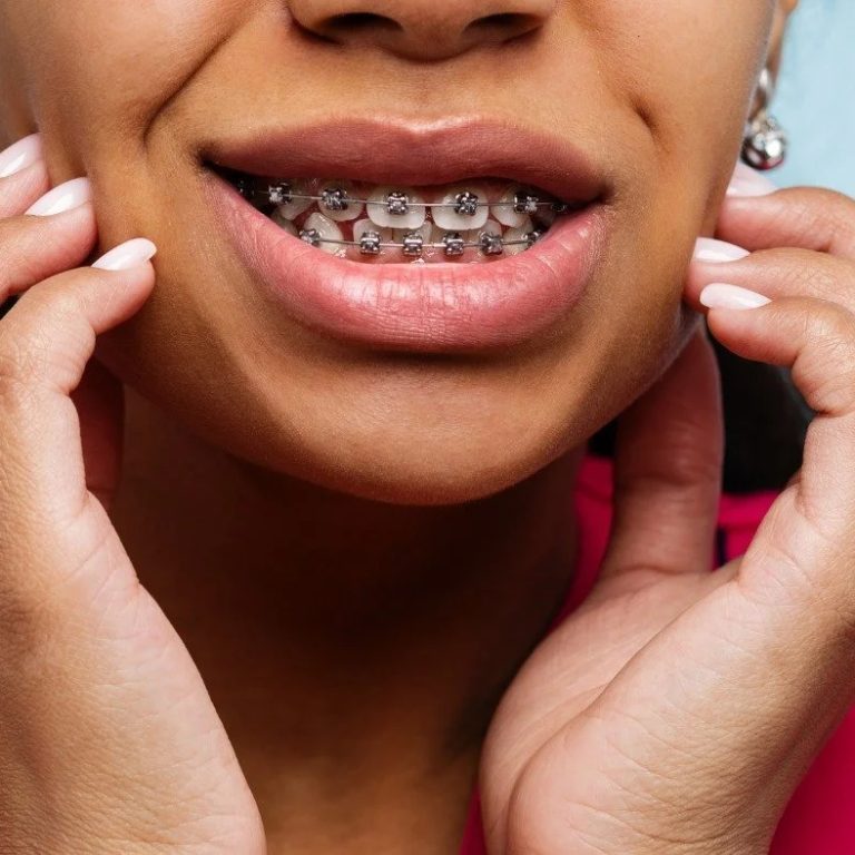 AchievingaHealthySmile