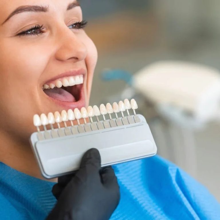 CaringforDentalImplants