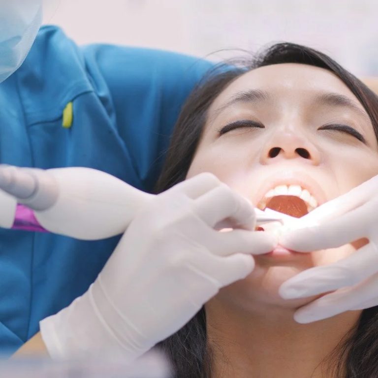 DentalDeepCleaning