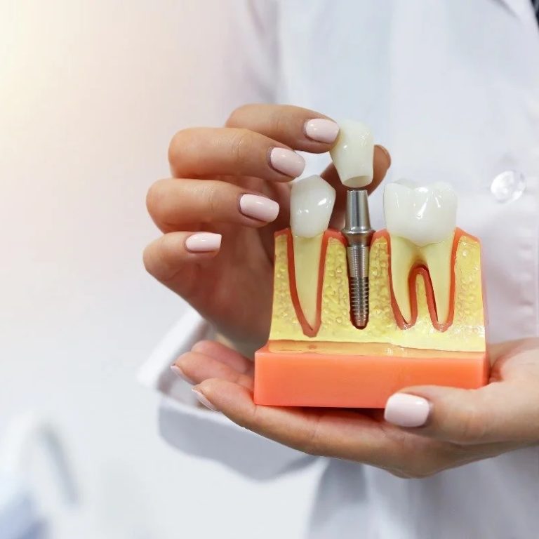 DentalImplantCost