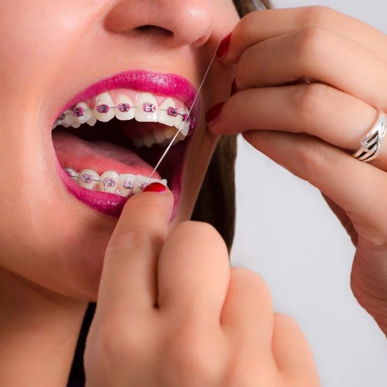 Flossing