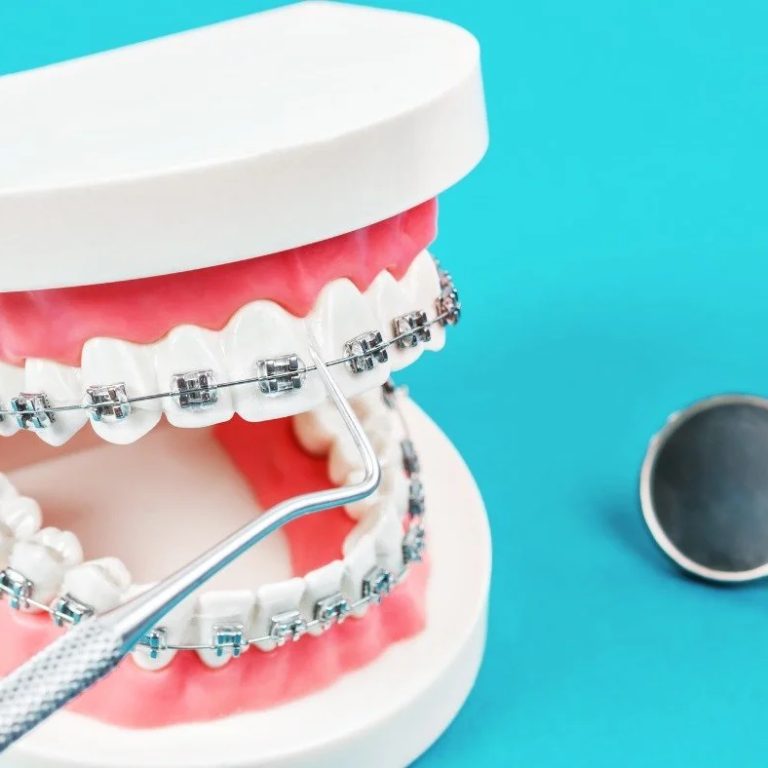 MindfulEatingDuringDentalTreatment