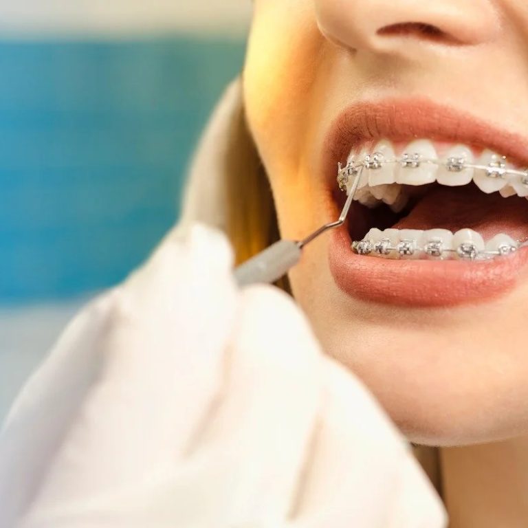 OurKitchenerDentist