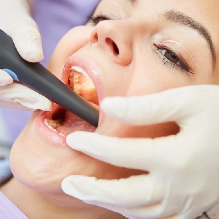 RootCanalRecovery