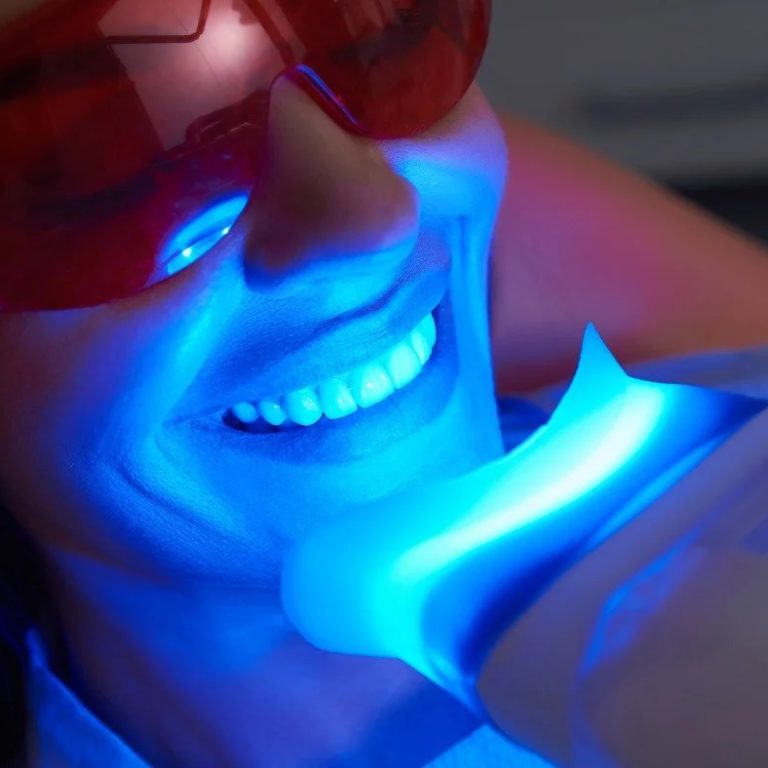 TeethWhiteningDentistCostinCanada