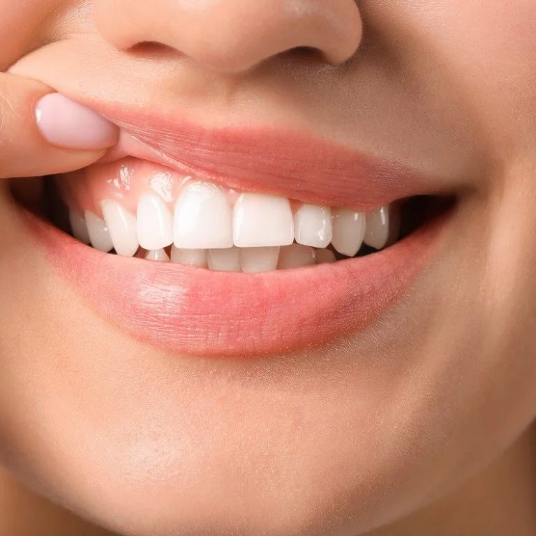 WhiteGums