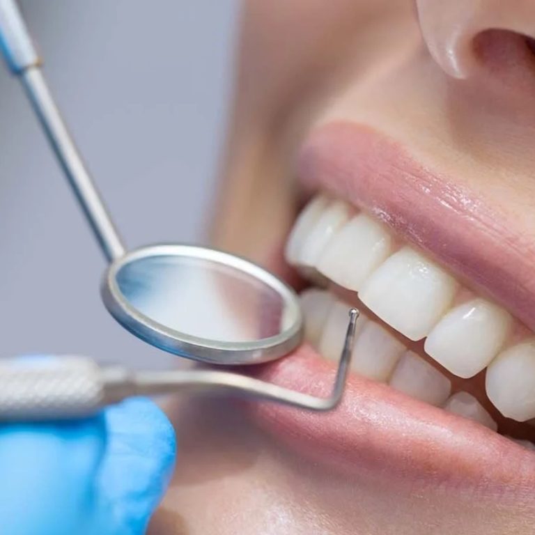 best-affordable-dentist-clinic-in-waterloo