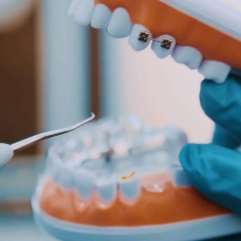 cosmetic-dental-treatments