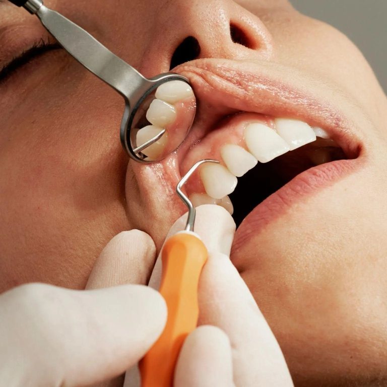 dental-hygiene