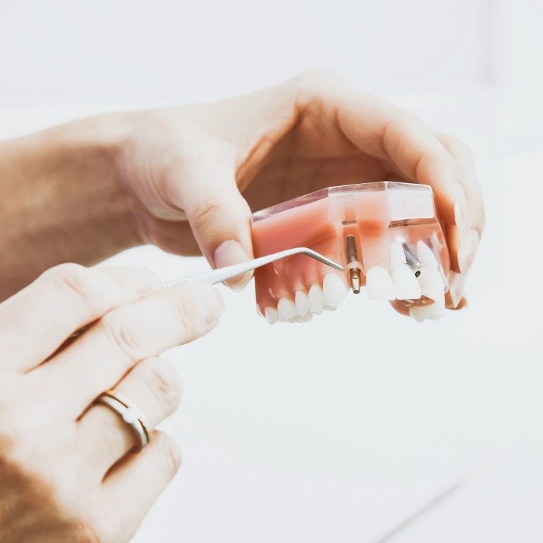 dental-implant-cost