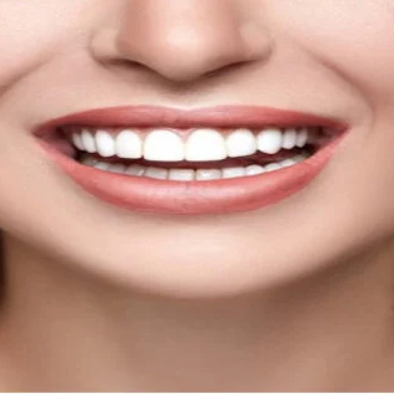 dentist-in-kitchener