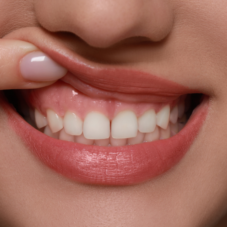 healthy-gums