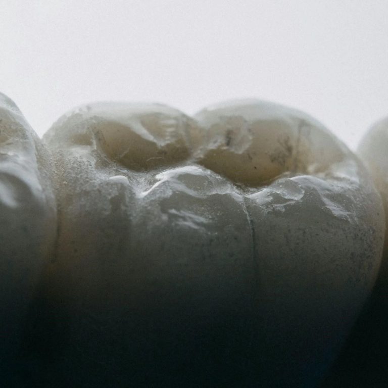 how-to-fix-a-cracked-tooth-naturally