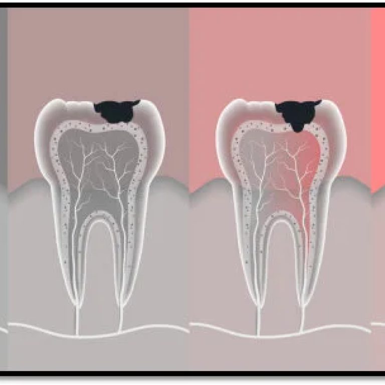 oral-hygiene