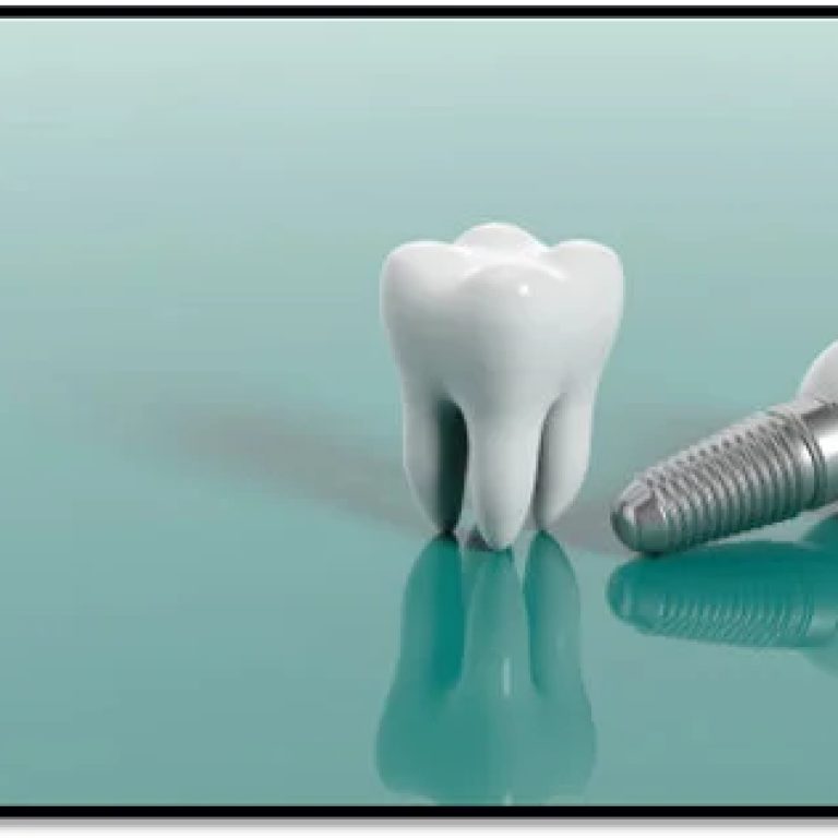 oral-pain