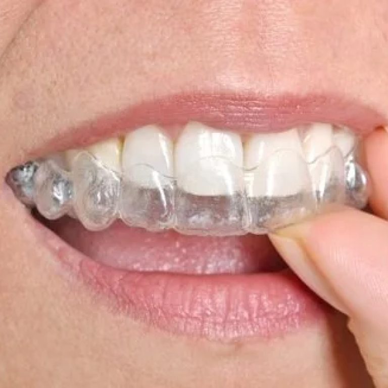 orthodonticsinWaterloo