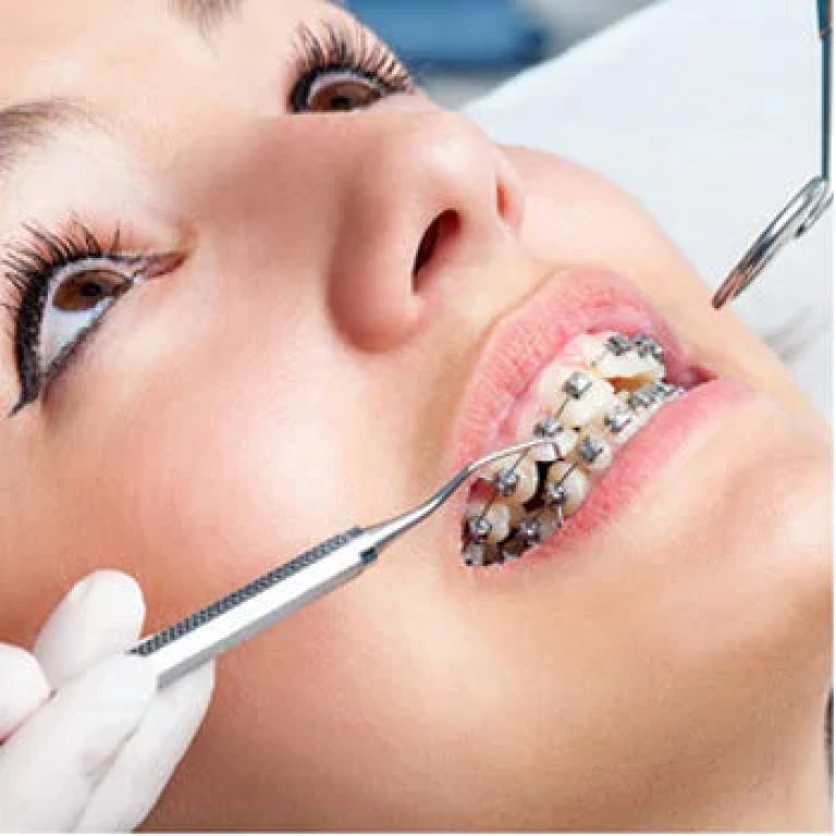 orthodontist-treatment