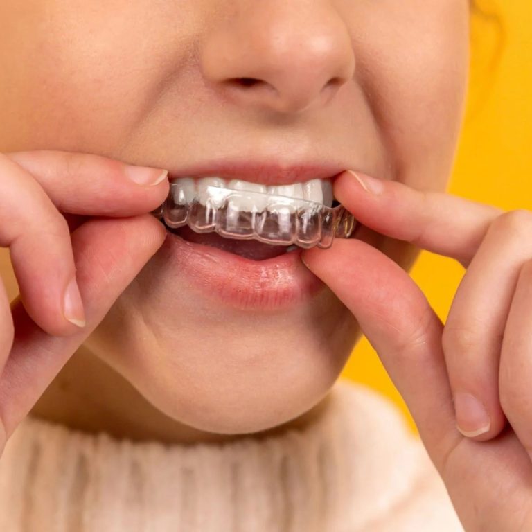 teeth-straightening